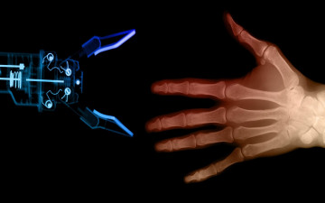 Картинка разное кости рентген