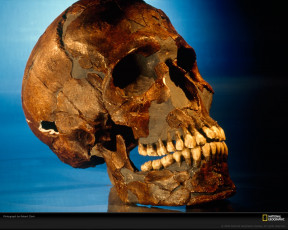 Картинка разное кости рентген