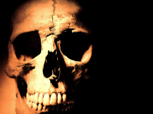 Картинка разное кости рентген