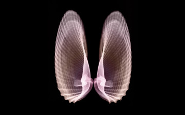 Картинка разное кости +рентген ракушки