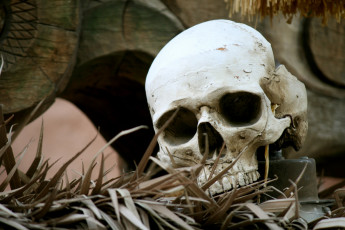 Картинка разное кости рентген череп