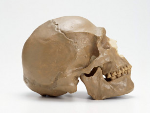 Картинка разное кости рентген