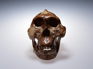 Картинка разное кости рентген